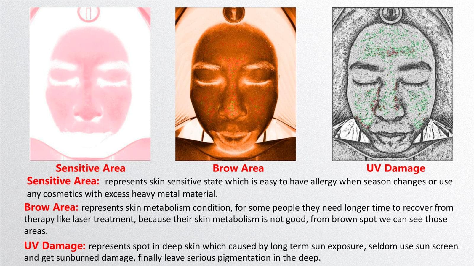 Pigment and spots